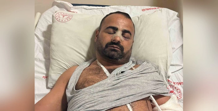 Iğdır'da dehşet verici darp olayı: Eski eşin akrabası tarafından saldırıya uğradı