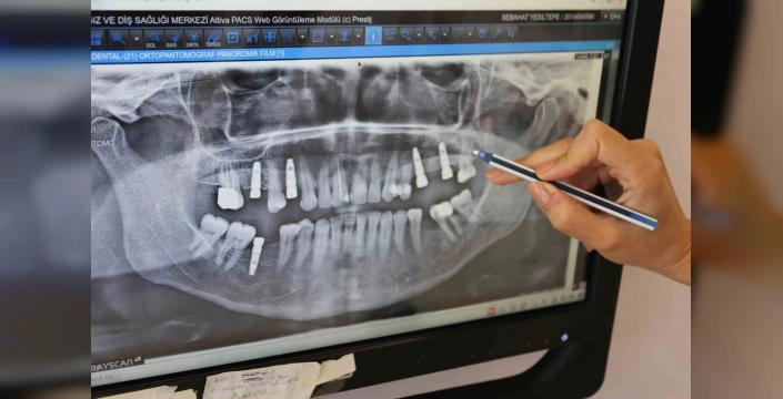 Manisa Ağız ve Diş Sağlığı Merkezi'nde 164 implant uygulaması