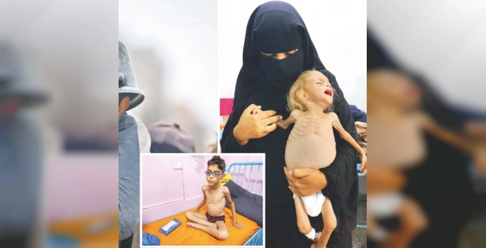 Gazze'de açlıktan ölü sayısı 217'ye yükseldi