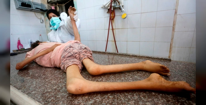 Gazze'de açlıktan ölümler artıyor: Son 24 saatte 7 kişi hayatını kaybetti