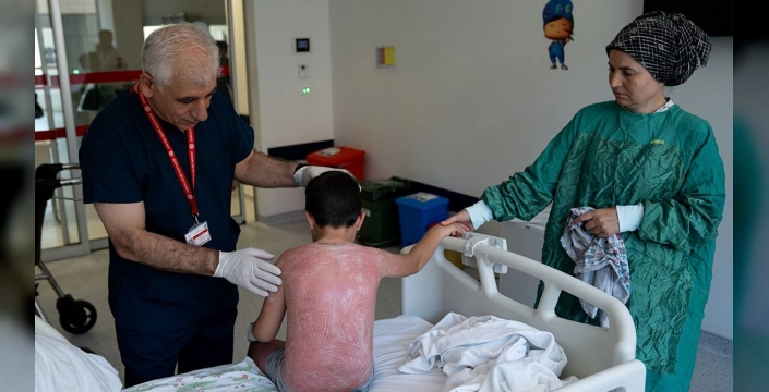 Samsun'da 7 yaşındaki çocuk güneş yanığına yakalandı